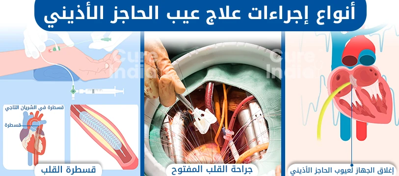 أنواع إجراءات علاج عيب الحاجز الأذيني في الهند